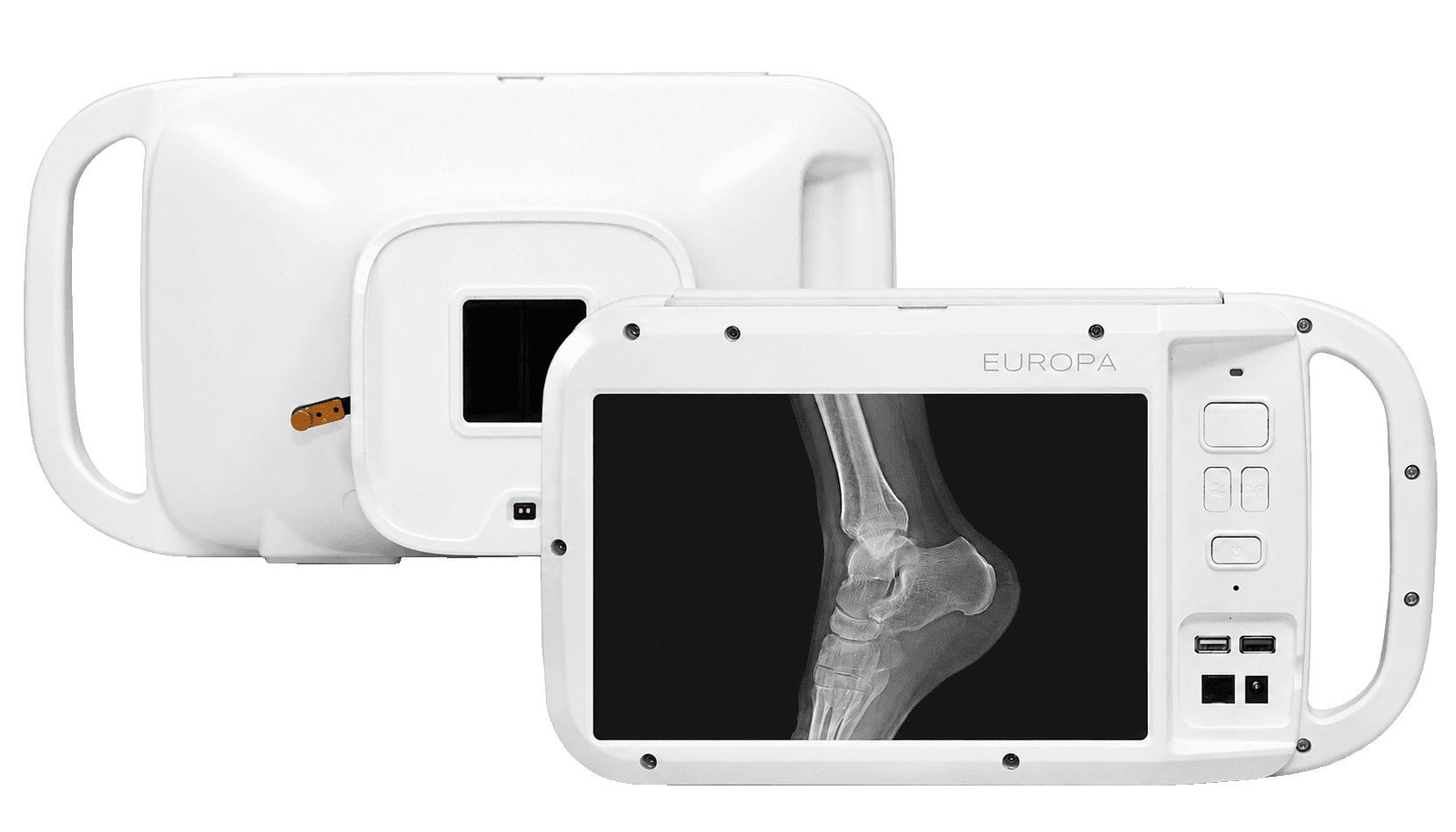 Europa90 portable X-ray